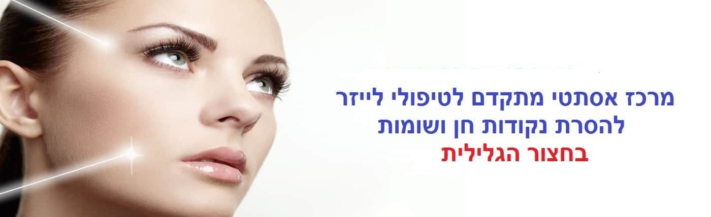 הסרת נקודות חן ושומות בחצור הגלילית