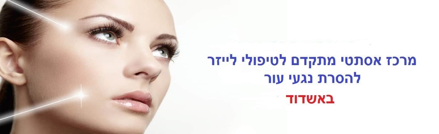 הסרת נגעי עור באשדוד