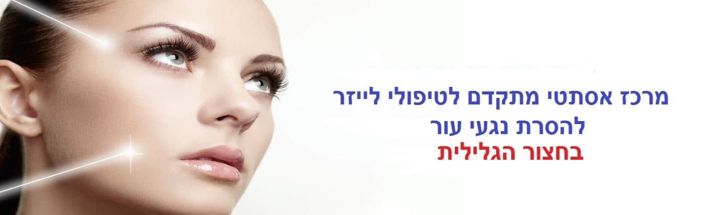הסרת נגעי עור בחצור הגלילית