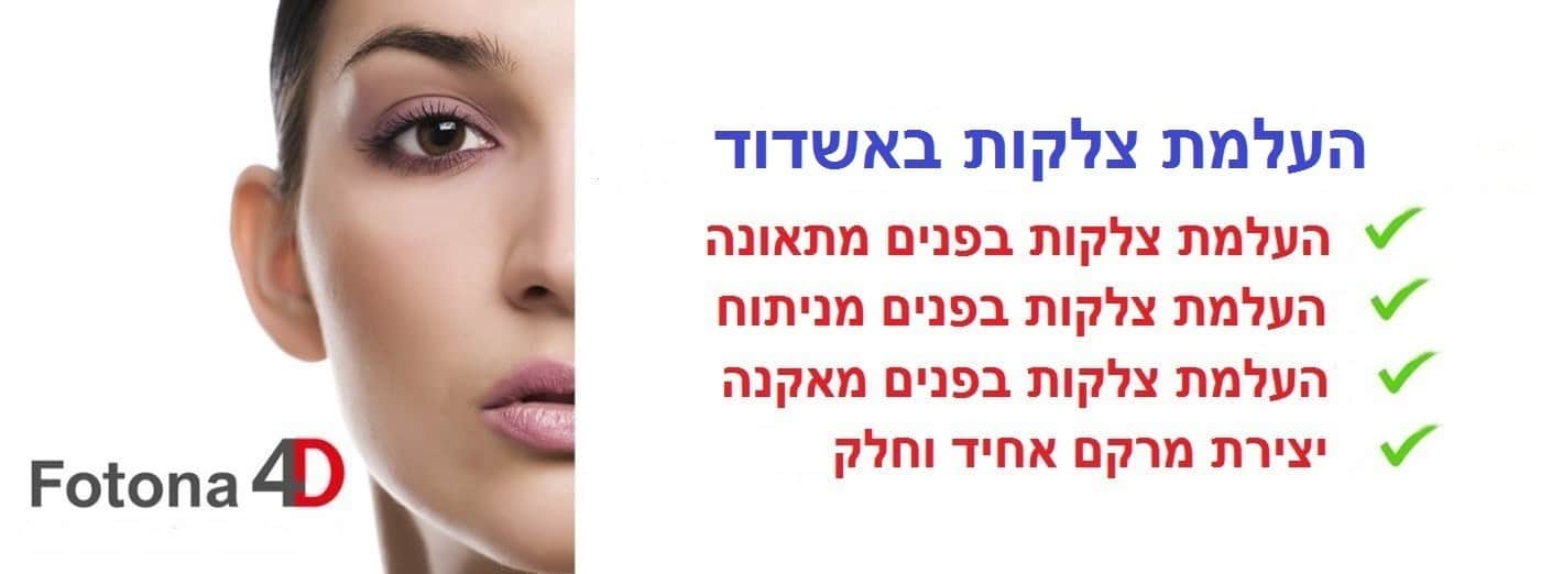 העלמת צלקות באשדוד | הסרת צלקות באשדוד