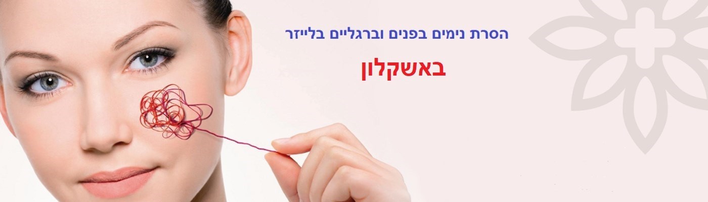 הסרת נימים באשקלון | העלמת נימים באשקלון