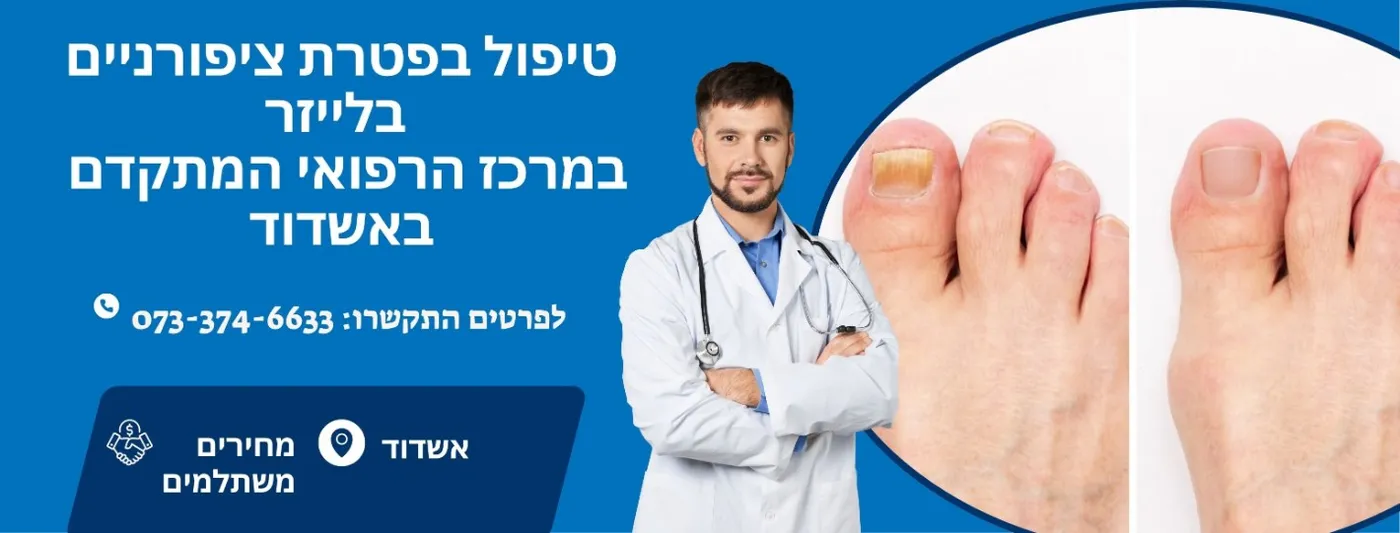 טיפול בפטרת ציפורניים בלייזר באשדוד