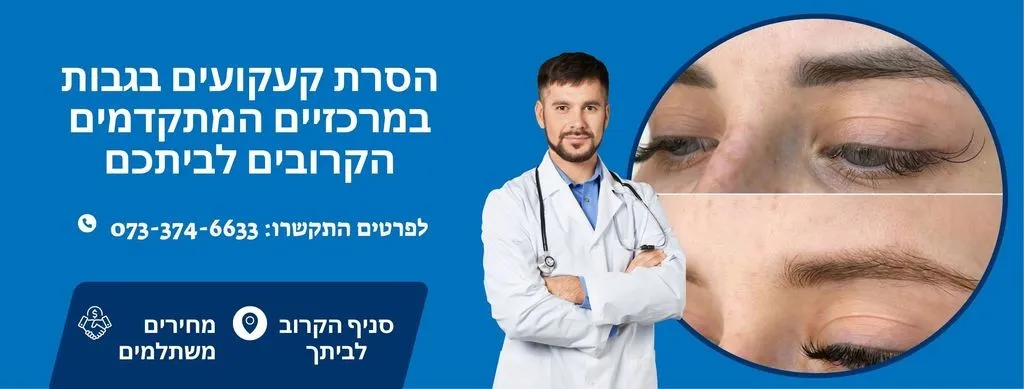 הסרת קעקועים בגבות