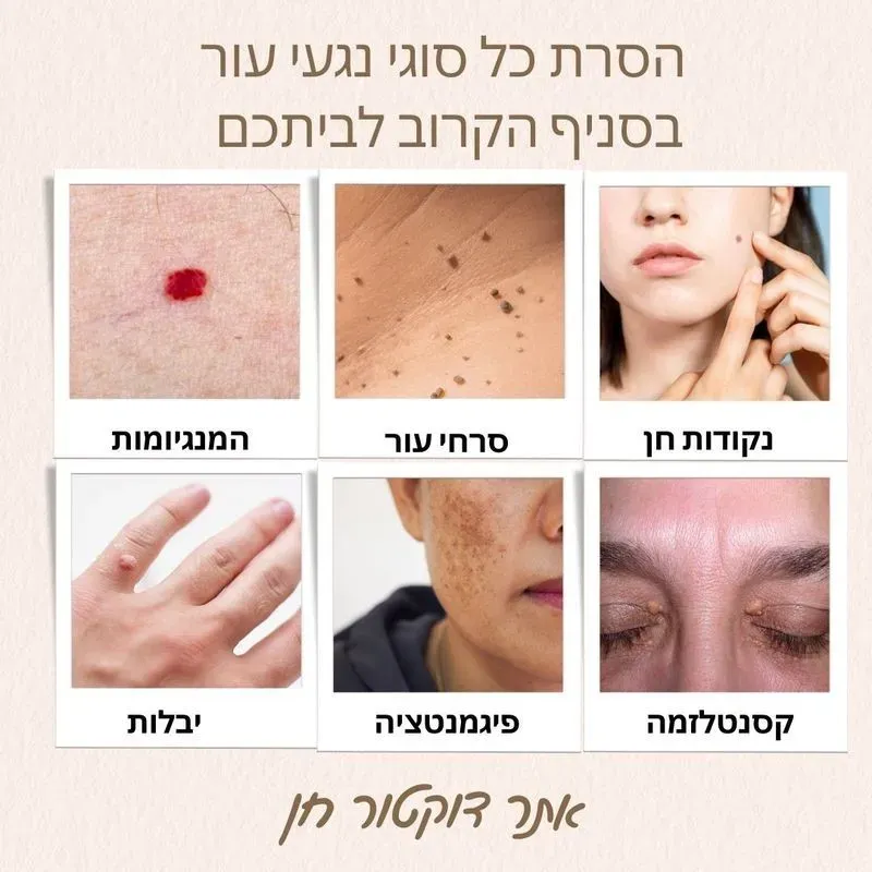 הסרת כל סוגי נגעי העור