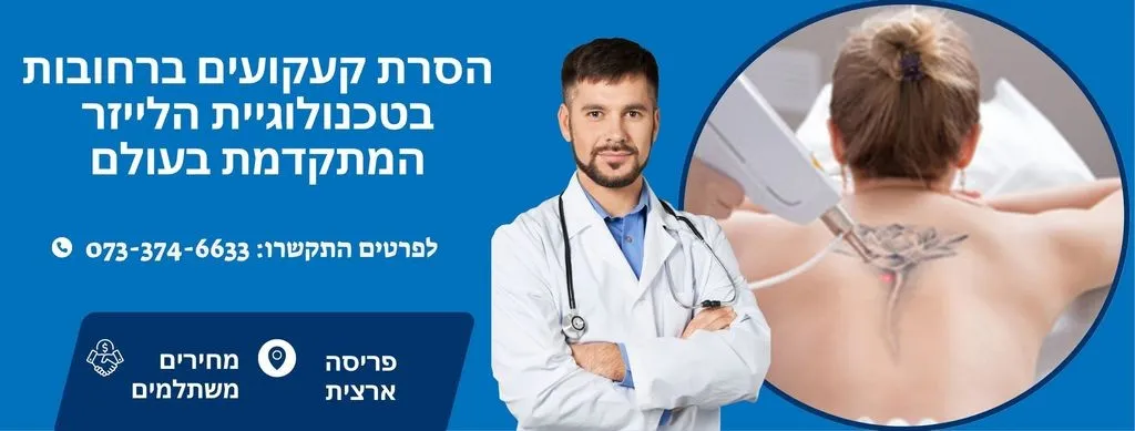 הסרת קעקועים ברחובות