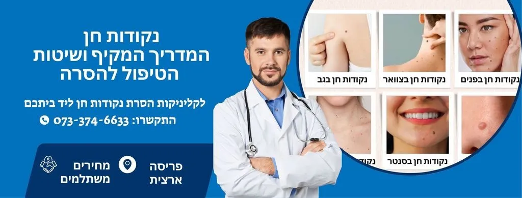 נקודות חן