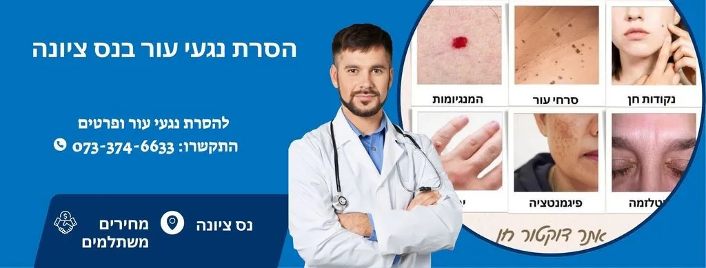 הסרת נגעי עור בנס ציונה