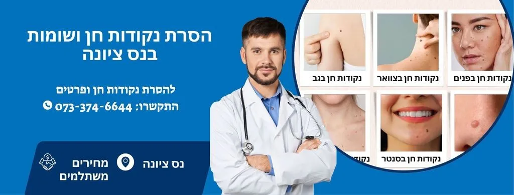 הסרת נקודות חן ושומות בנס ציונה