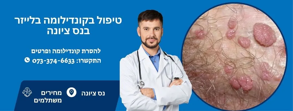 טיפול בקונדילומה בנס ציונה