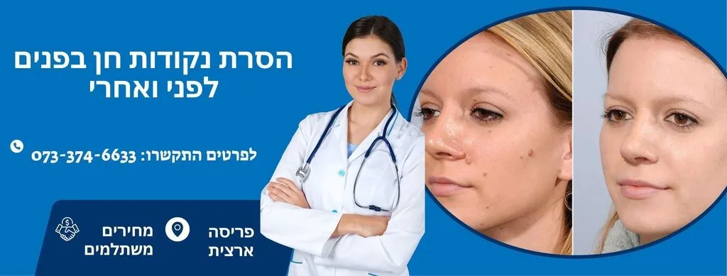 הסרת נקודות חן בפנים - לפני ואחרי
