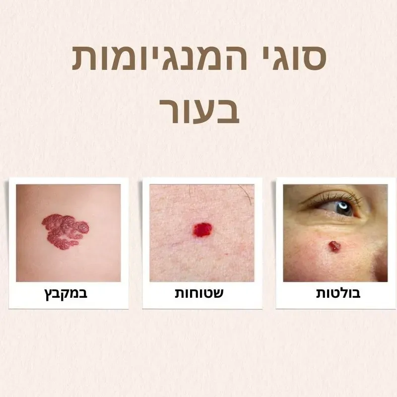 סוגי נקודות אדומות על העור