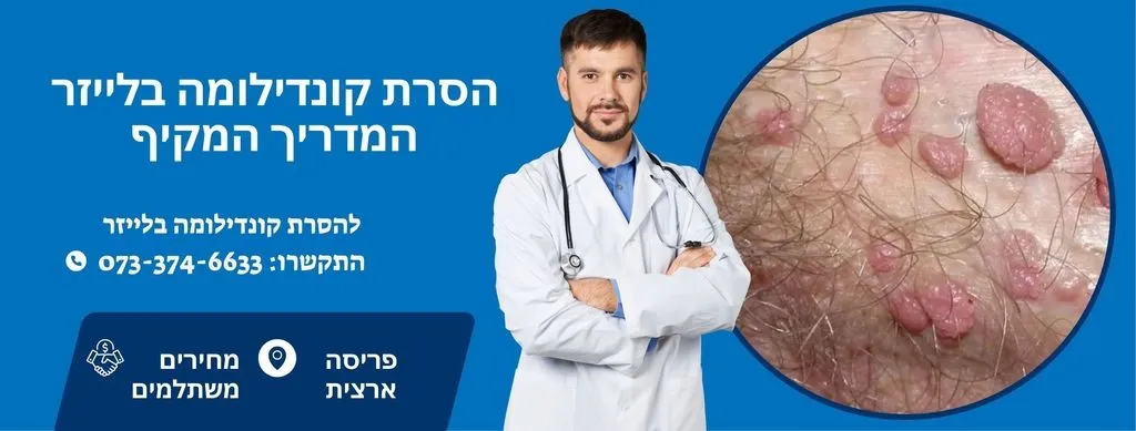 הסרת קונדילומה