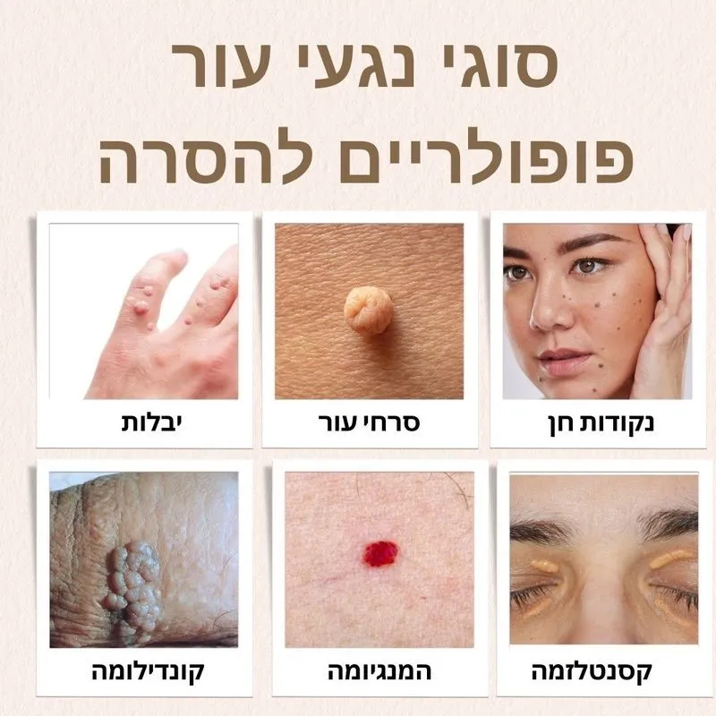 סוגי נגעי עור פופולריים להסרה