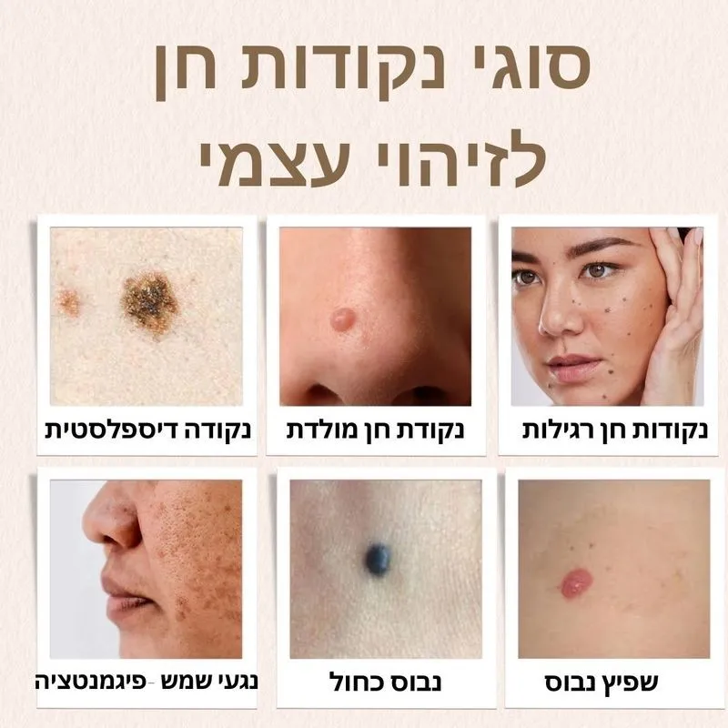 סוגי נקודות חן לזיהוי עצמי