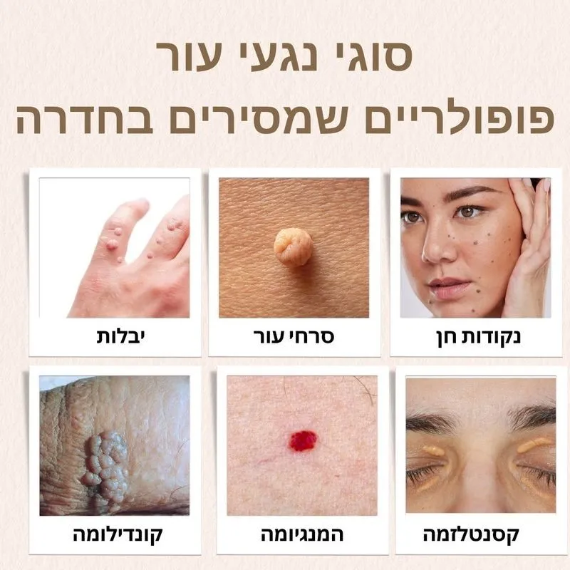סוגי הסרת נגעי עור בחדרה
