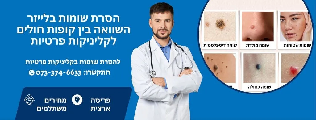 הסרת שומות בלייזר
