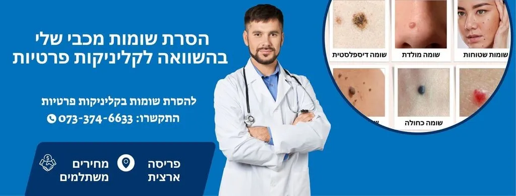 הסרת שומות מכבי שלי