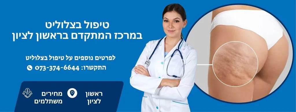 טיפול בצלוליט בראשון לציון