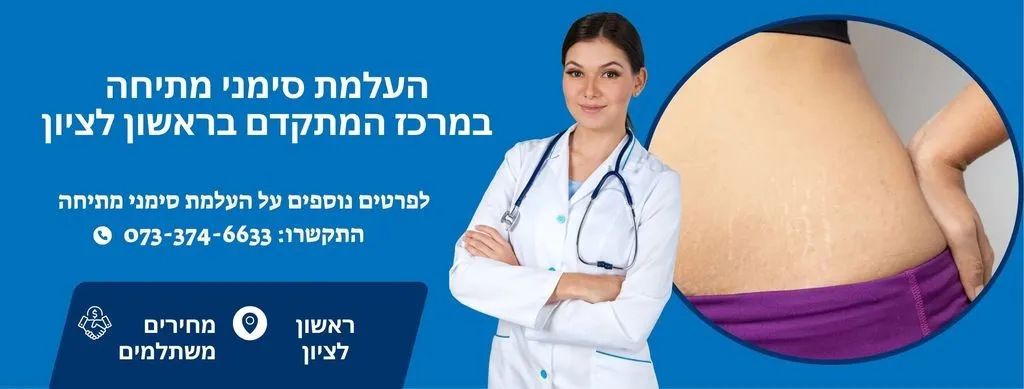 העלמת סימני מתיחה בראשון לציון