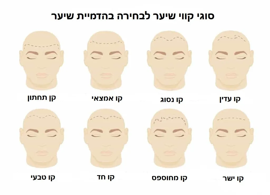 המלצות לבחירת קו שיער להדמיית שיער