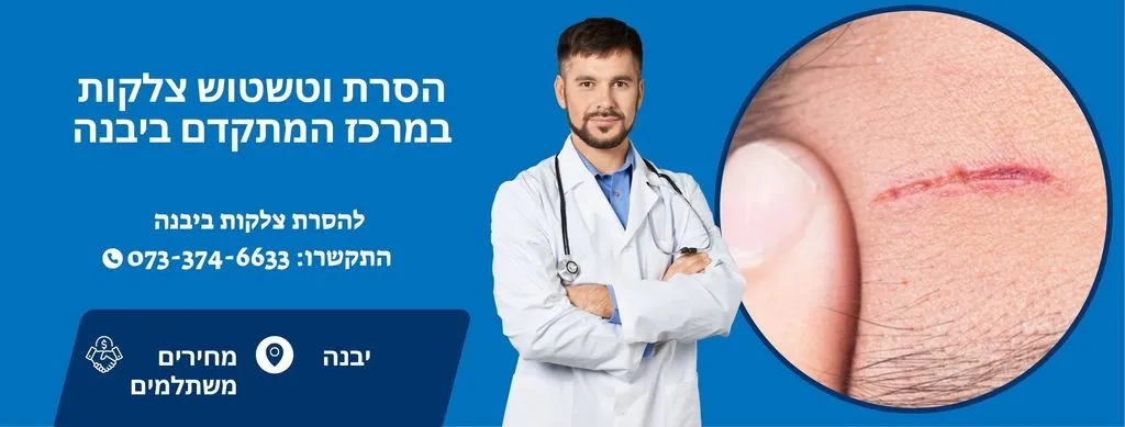 הסרת צלקות ביבנה | העלמת צלקות ביבנה