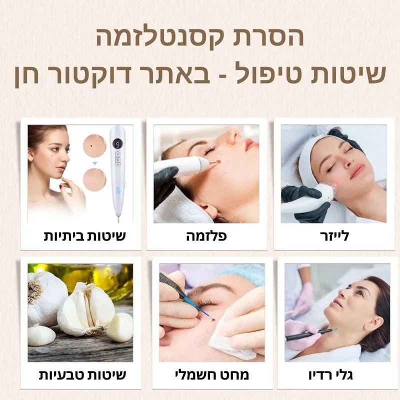 שיטות טיפול הסרת קסנטלזמה