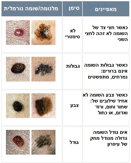 נגעי עור שפירים בהשוואה לנגעי עור עם חשש למלנומה מה ההבדל