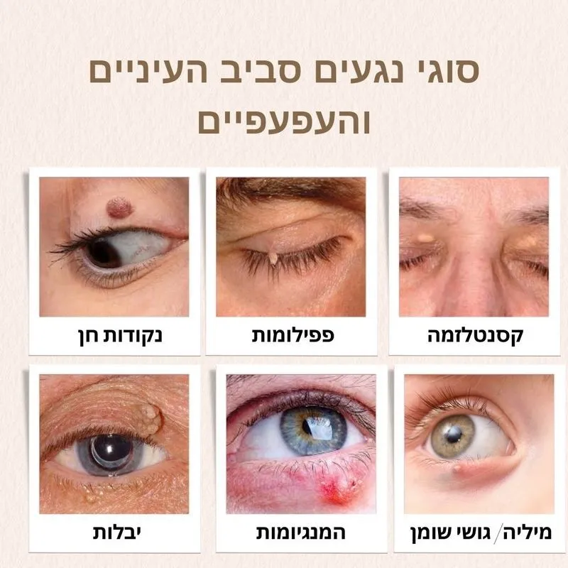 סוגי נגעים סביב העיניים והעפעפיים