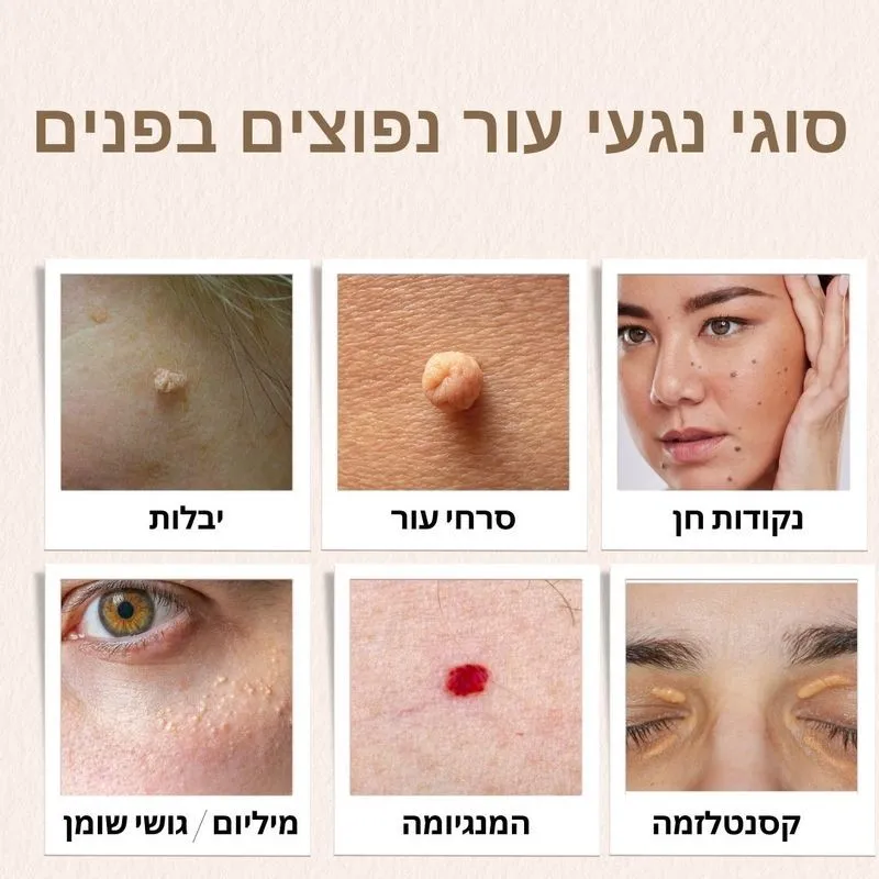 סוגי נגעי עור בפנים