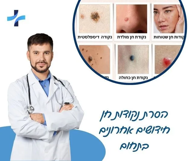 הסרת נקודות חן - חידושים בתחום - מעודכן תאריך: 11/1/2026