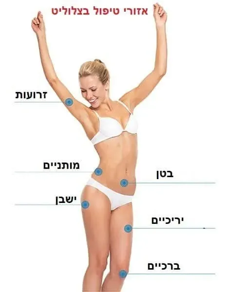 טיפול בצלוליט באשקלון