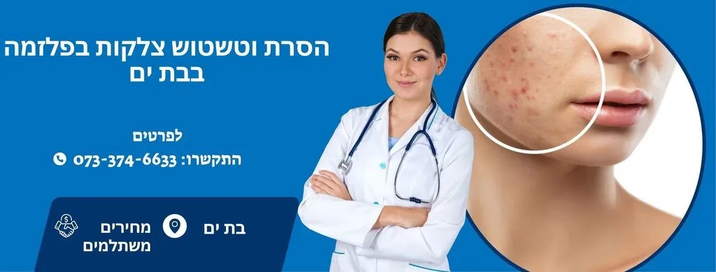 הסרת צלקות בבת ים