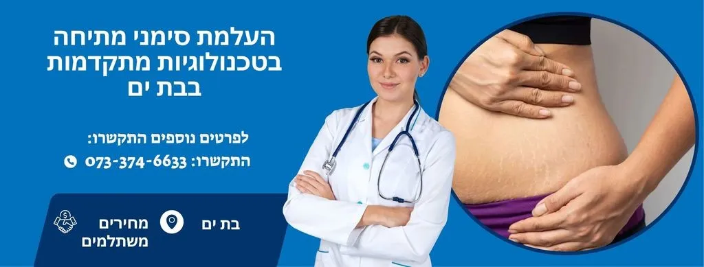 העלמת סימני מתיחה בבת ים