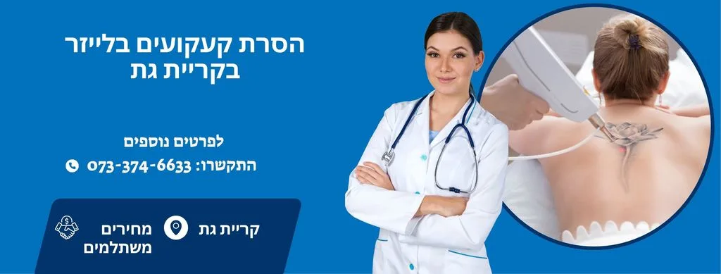 הסרת קעקועים בקריית גת
