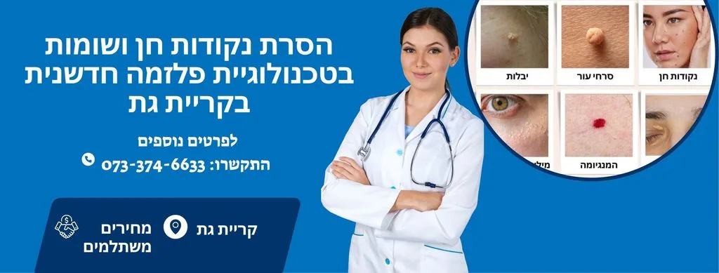 הסרת נקודות חן בקריית גת