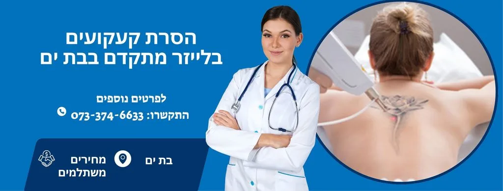 הסרת קעקועים בלייזר בבת ים