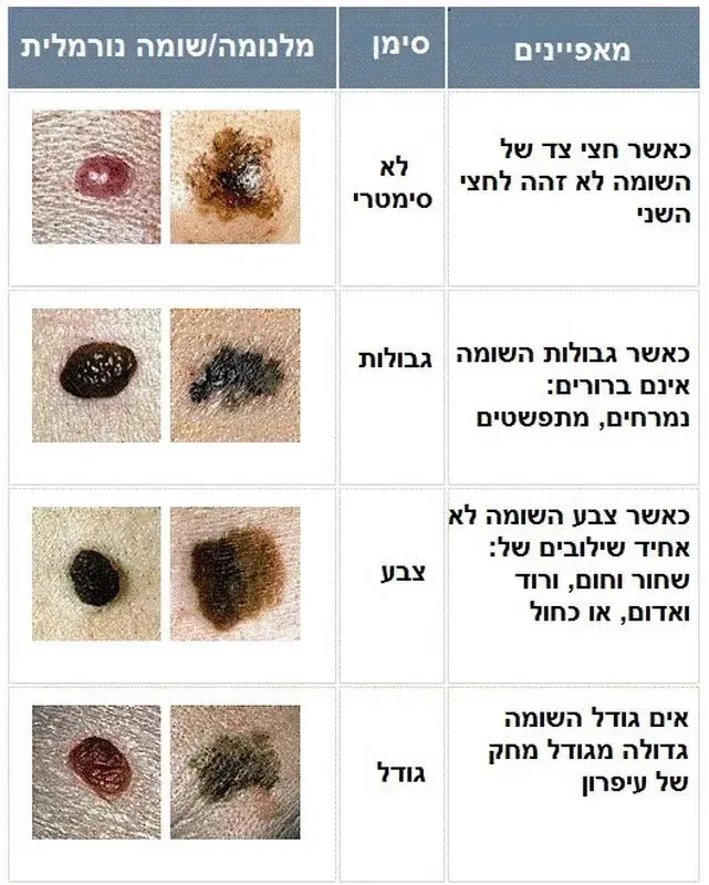 סימנים מחשידים שאותרו בבדיקה הדרמוסקופית להסרת נקודות חן