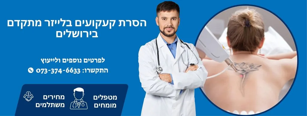 הסרת קעקועים בירושלים