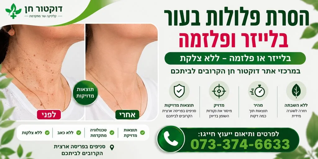 הסרת פלולה