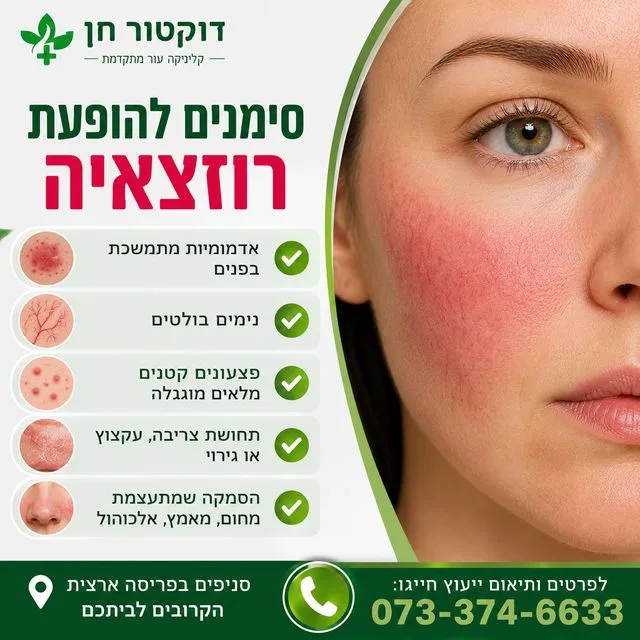 סימנים להופעת רוזצאיה