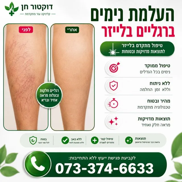 העלמת נימים ברגליים | הסרת נימים ברגליים