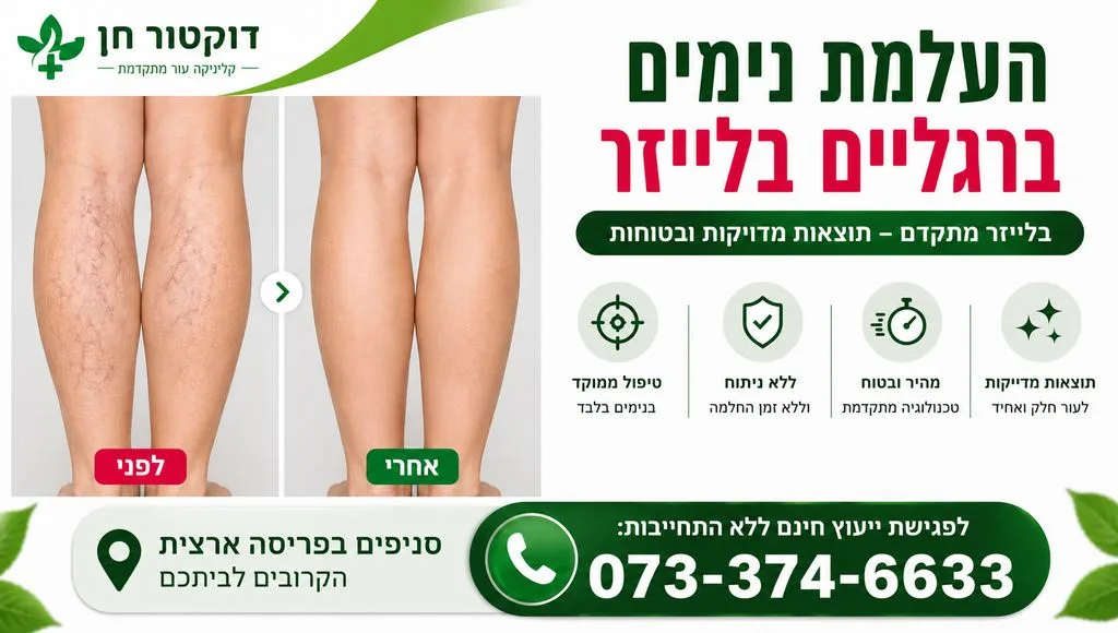 העלמת נימים ברגליים
