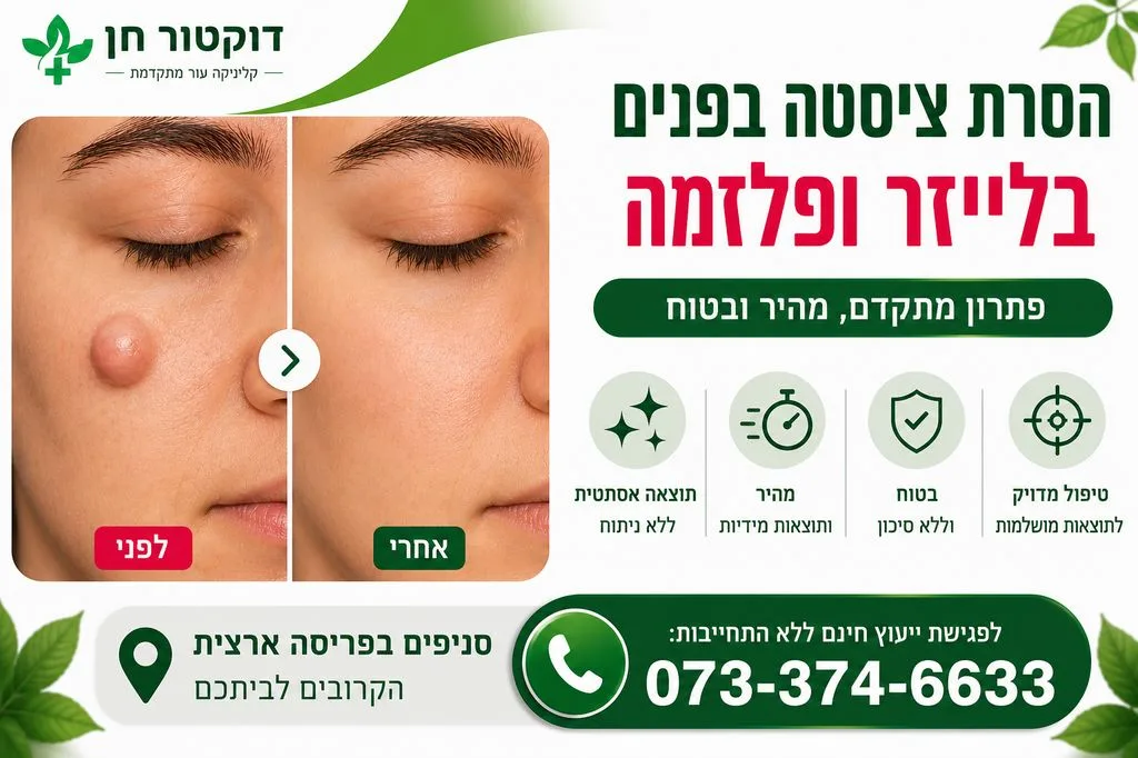 הסרת ציסטה