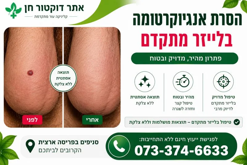 הסרת אנגיוקרטומה 