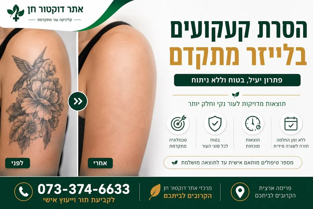 הסרת קעקועים בלייזר