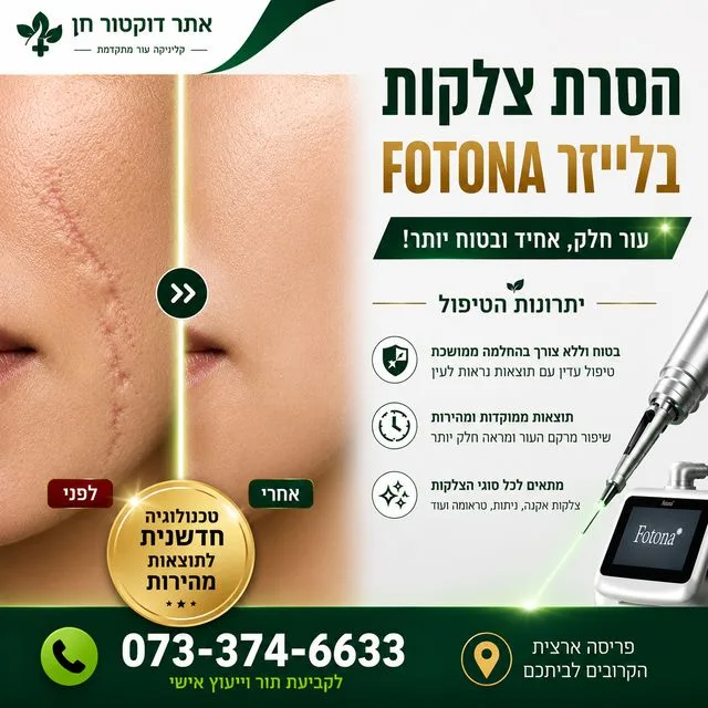 הסרת צלקות בלייזר FOTONA יתרונות