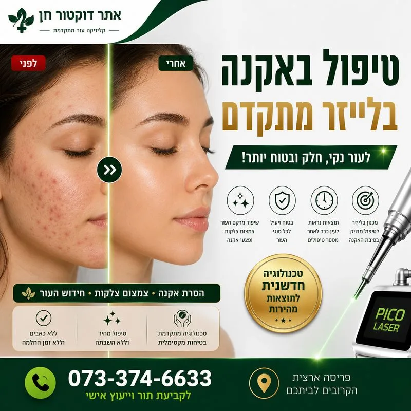 טיפול באקנה בלייזר