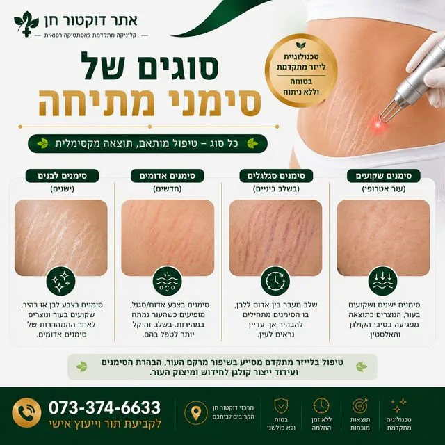 סוגים של סימני מתיחה