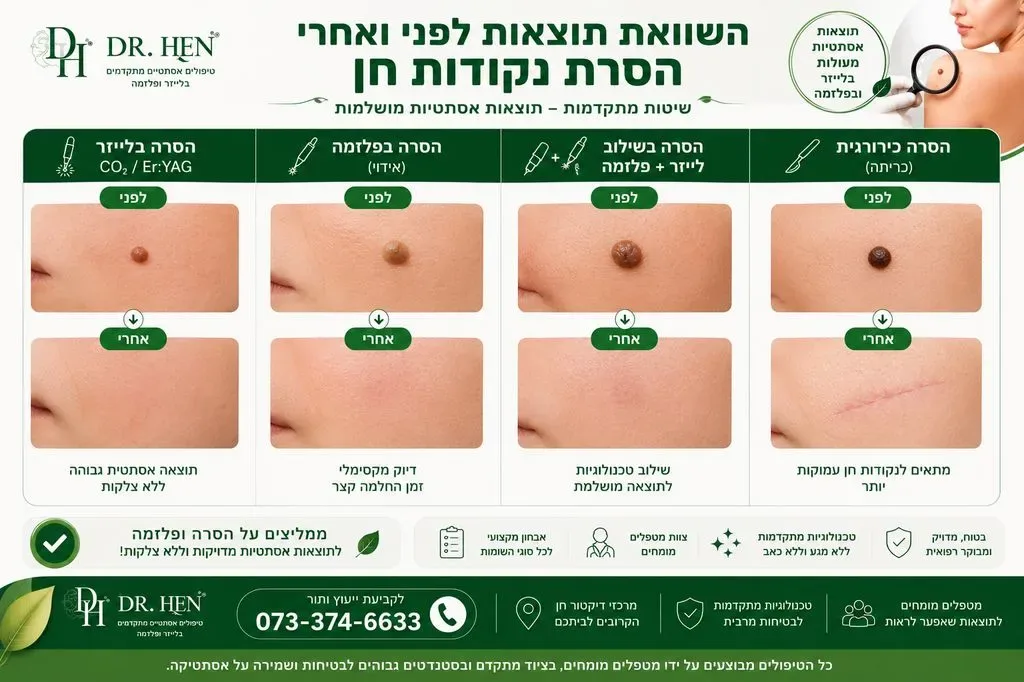 הסרת נקודות חן - תוצאות לפני ואחרי לפי שיטת טיפול
