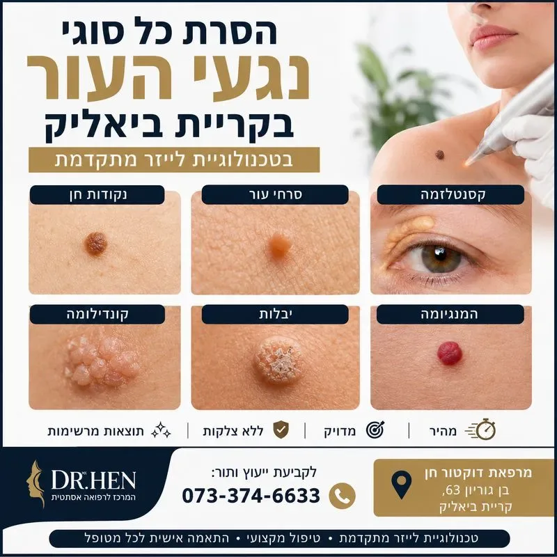 הסרת נגעי עור בקריית ביאליק בצפון